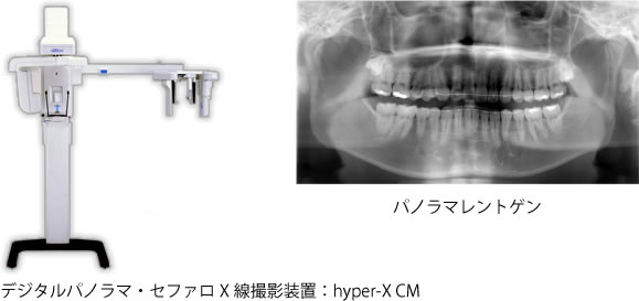 画像｜デジタルパノラマ・セファロX線撮影装置